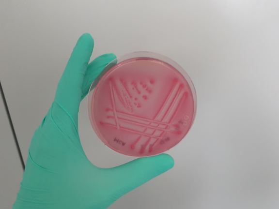 Escherichia coli on MacConkey agar